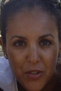 Khadija fajry dark spots before using prickly pear seed oil